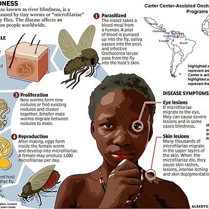 Niger becomes the first African country to eliminate a major blindness-inducing infection